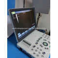 Factory price! MSLPU33-i Portable ultrasound machine/laptop B/W ultrasound machine price